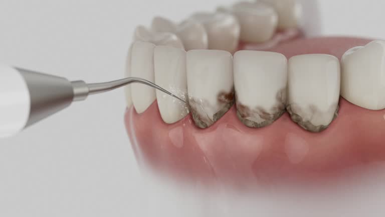Trusted Dental Crowns And Bridges service in Briarcliff, TX - Dentist Open Now